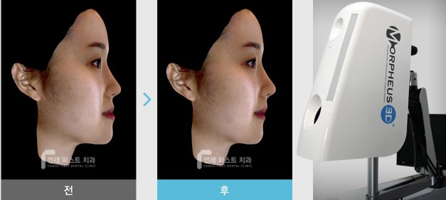 부천 상동 부분교정